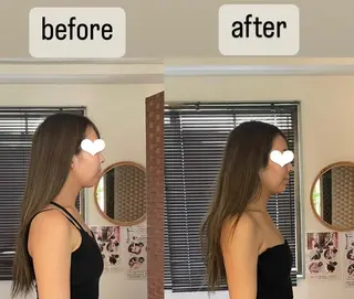 セミロング カラー ヘアアレンジ 代表  山下 智景のエステ・リラクイメージ