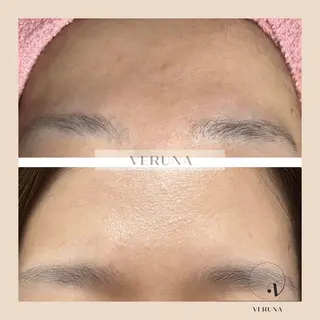 ピーリング専門店 Belluteのエステ・リラクイメージ