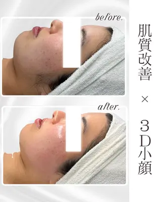 LiAm《美肌管理/ 小顔/脂肪ケア》のその他イメージ