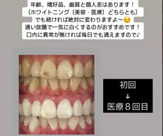 Kaula ホワイトニング🦷✨のエステ・リラクイメージ