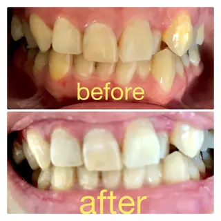 two nailのネイルデザイン