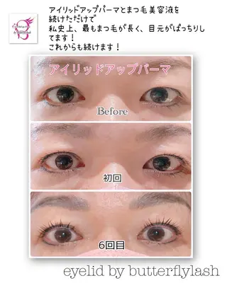 マツエク・マツパ 下がりまつ毛たるみ 専門サロン妙蓮寺駅のマツエク・マツパデザイン