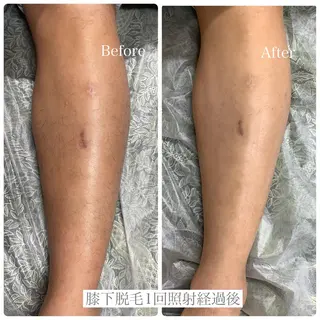 DISINI  SPA所属・DISINISPA 脱毛/フェイシャルのエステ・リラクイメージ