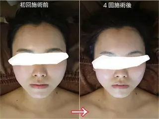 小顔美容整体& 美爪育成Jelissのエステ・リラクイメージ