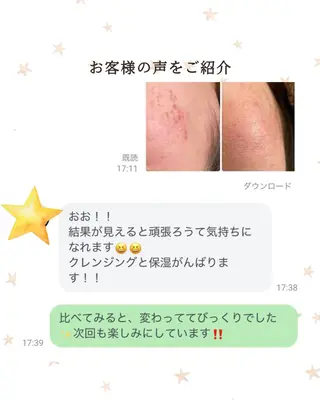 フェイシャルサロン ビアンカガーデンのエステ・リラクイメージ