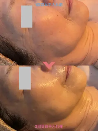 エステサロン Libertaのその他イメージ