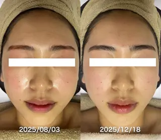 韓国美肌/肌質改善 【天神】のエステ・リラクイメージ