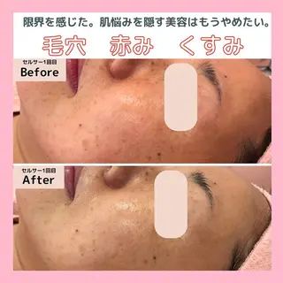 三沢市エステサロン Sブランペタルのエステ・リラクイメージ