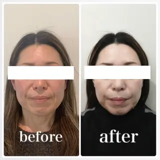 小顔と ヘッドスパのお店のエステ・リラクイメージ