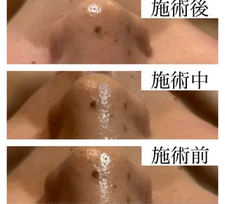 ネイル&エステ phuan(プアン)のネイルデザイン