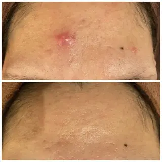 セミロング カラー パーマ ヘアアレンジ メンズ キッズ ネイル マツエク・マツパ アイブロウ 3か月で肌革命👼 ニキビ専門店💫のエステ・リラクイメージ