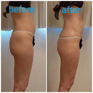 トータルビューティー サロン　Reiのエステ・リラクイメージ