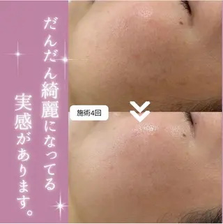 【現役看護師】高来 笑子のエステ・リラクイメージ