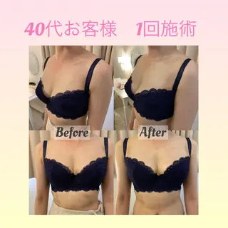 Ele’na バスト&フェイシャルのエステ・リラクイメージ