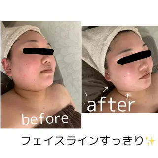ビューティーサロン Lemoのエステ・リラクイメージ