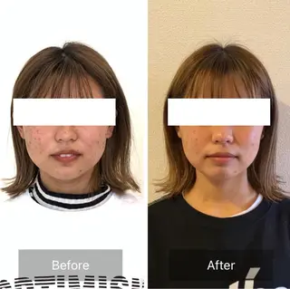 小顔と ヘッドスパのお店のエステ・リラクイメージ