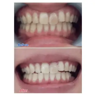 M渋谷 ホワイトニングのエステ・リラクイメージ