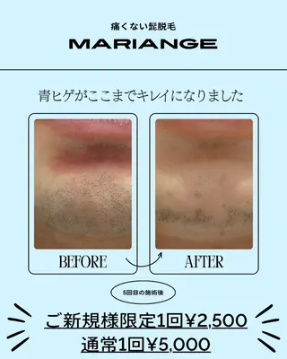 メンズ mariange 〜美肌・美容脱毛〜のエステ・リラクイメージ