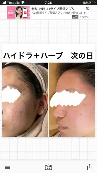 ミディアム カラー パーマ ヘアアレンジ メンズ キッズ ネイル マツエク・マツパ アイブロウ ハーブピーリング専門 🌿モッカのエステ・リラクイメージ