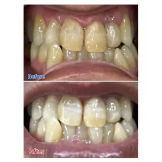 M渋谷 ホワイトニングのエステ・リラクイメージ