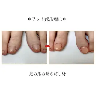 ネイル ネイルサロン アリュームのネイルデザイン