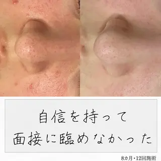 ニキビ経験者が施術 する専門サロン🌻のエステ・リラクイメージ
