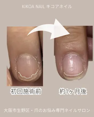 ネイル KIKOA NAIL キコアネイルのネイルデザイン