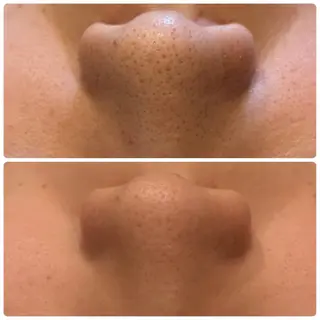 yellow💛【 脱毛&フェイシャル】のエステ・リラクイメージ