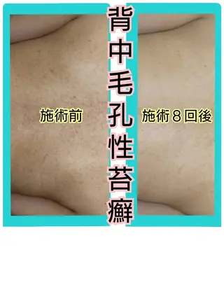 ハーブピーリング 専門店Kikkaのエステ・リラクイメージ