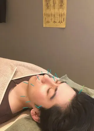 メンズ 【パーソナル鍼灸】 Pintのエステ・リラクイメージ