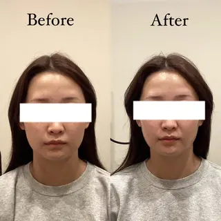 seika🍒 ハリラウンジ梅田のエステ・リラクイメージ