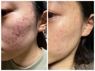 Natura ナトァーラのヘアスタイル