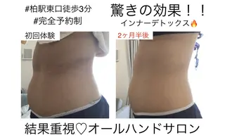 子宮矯正/腸揉み/ シュガーリング脱毛のエステ・リラクイメージ