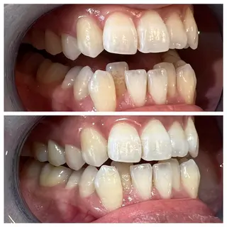 セルフホワイトニング Shineeのエステ・リラクイメージ