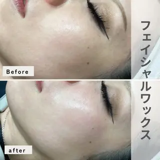 ciena salonのエステ・リラクイメージ