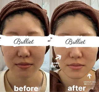 ブリリエット 文山のエステ・リラクイメージ