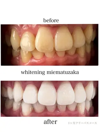 ホワイトニングショップ三重松阪店所属・ホワイトニング ショップ三重松阪店の眉毛・アイブロウイメージ