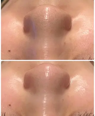 メンズ 美 Faceのエステ・リラクイメージ