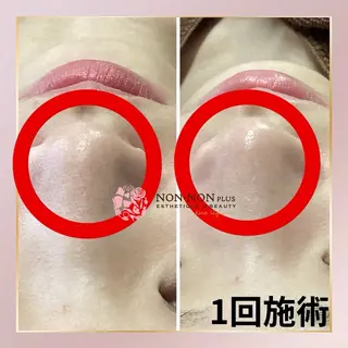 NON-NONプラス 大人の本気痩身のエステ・リラクイメージ