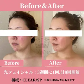 メンズ 有人型セルフサロン 脱毛／痩身／美顔のエステ・リラクイメージ