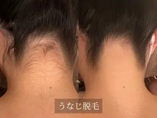 脱毛サロン Arumのエステ・リラクイメージ