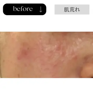 beauty CHOOSEのエステ・リラクイメージ