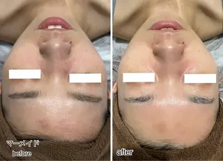 ENCHANT Kaede/肌質改善のその他イメージ