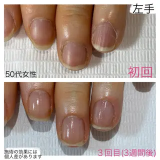 ネイル 自爪育成専門サロン エムロードゥ池下のネイルデザイン