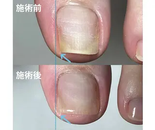 ネイル Junko peg新丸子のネイルデザイン