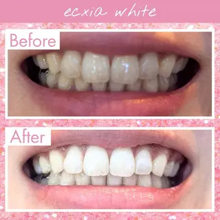 セルフホワイトニング エクシア戸田公園店のその他イメージ