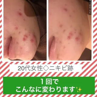 ショート カラー パーマ ヘアアレンジ メンズ キッズ ネイル マツエク・マツパ ニキビ・肌質改善専門 ♡人生が変わるサロンのエステ・リラクイメージ