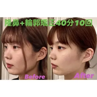 隆鼻矯正専門店ラプリ 古越のエステ・リラクイメージ