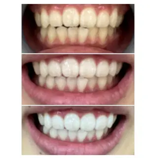 Ｍ渋谷 ホワイトニングのエステ・リラクイメージ