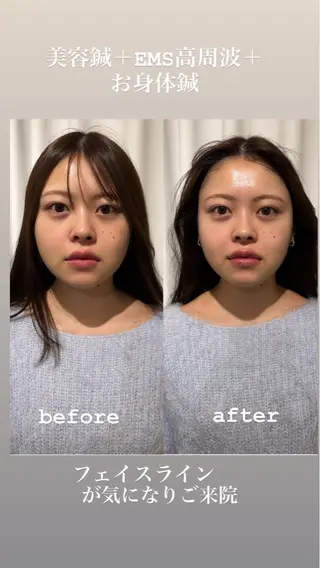 美容鍼灸サロン mahoroba院長のエステ・リラクイメージ